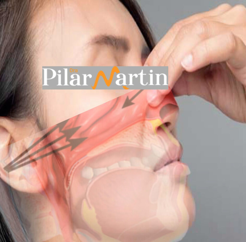 La obstrucción nasal crónica puede provocar alteraciones en la boca.